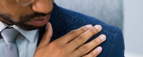 dandruff on shoulder